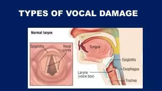 TYPES OF VOCAL DAMAGE