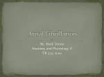 Atrial Fibrillation - slide 1