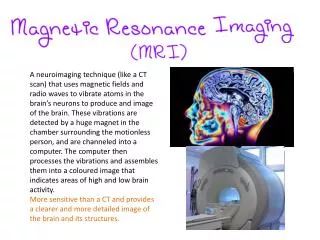 Able to display extremely small changes in the brain