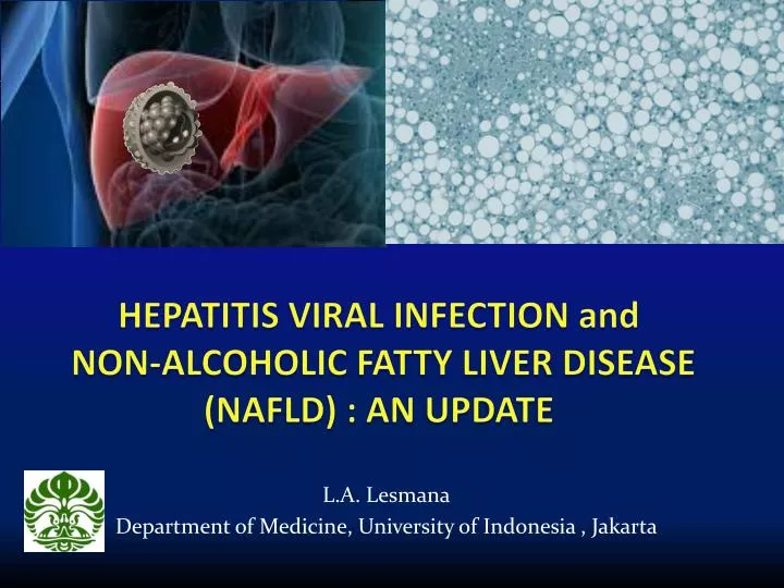 h epatitis viral infection and non alcoholic fatty liver disease nafld an update