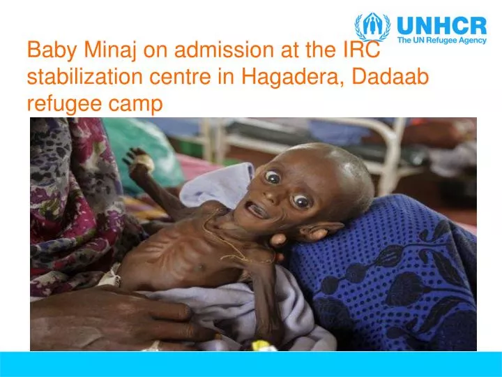 baby minaj on admission at the irc stabilization centre in hagadera dadaab refugee camp