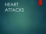 HEART ATTACKS