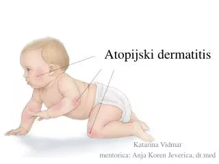 atopijski dermatitis