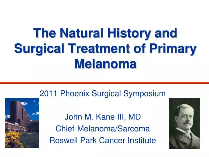 the natural history and surgical treatment of primary melanoma