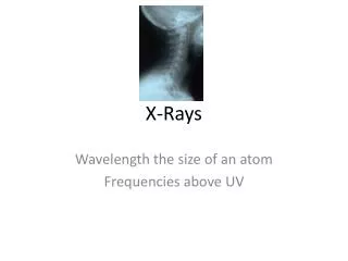 X-Rays