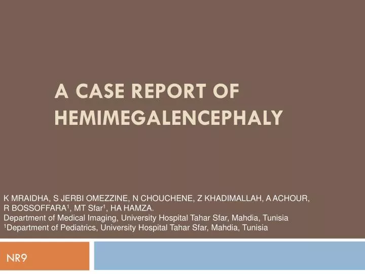 a case report of hemimegalencephaly