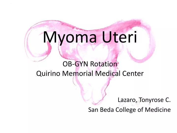 myoma uteri ob gyn rotation quirino memorial medical center