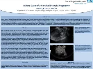 A Rare Case of a Cervical Ectopic Pregnancy