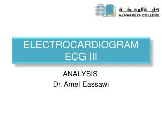Electrocardiogram ECG III