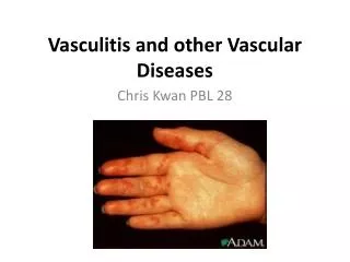 Vasculitis and other Vascular Diseases