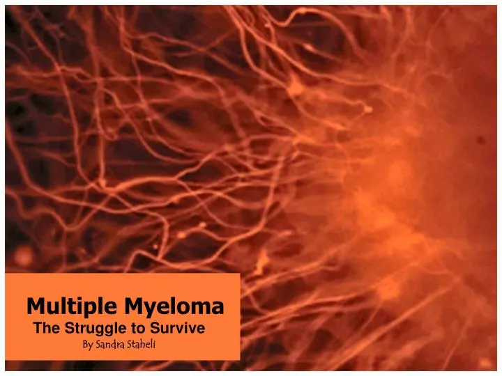 multiple myeloma