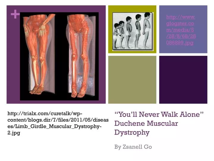 you ll never walk alone duchene muscular dystrophy