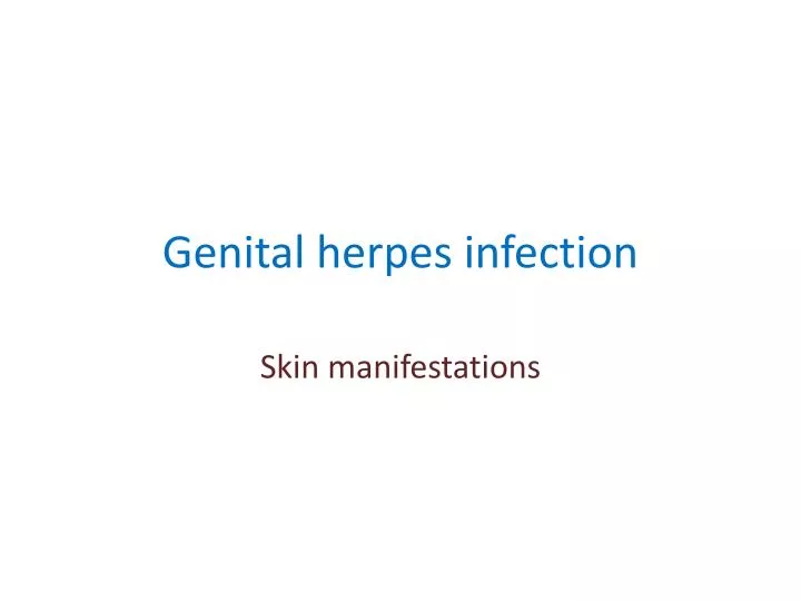 genital herpes infection