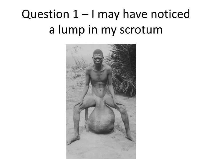 question 1 i may have noticed a lump in my scrotum