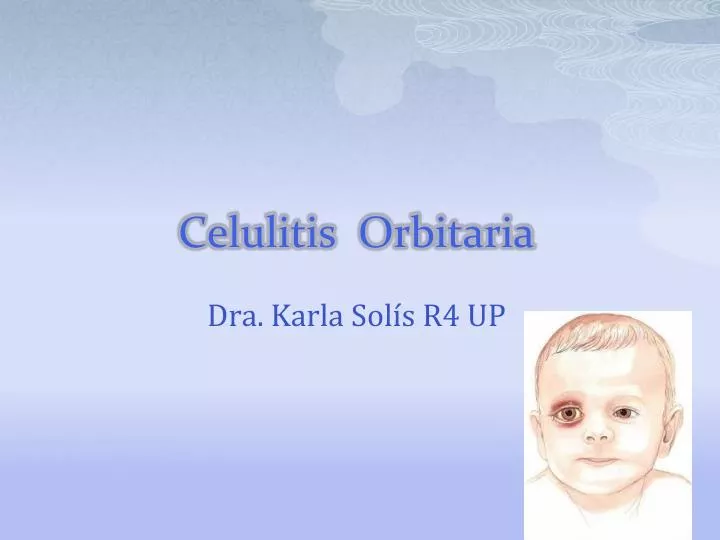 celulitis orbitaria