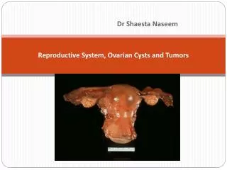 Reproductive System, Ovarian Cysts and Tumors