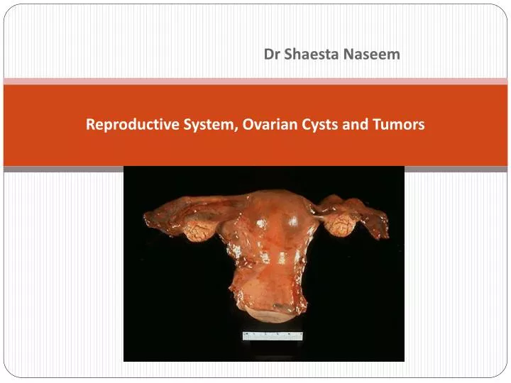 reproductive system ovarian cysts and tumors