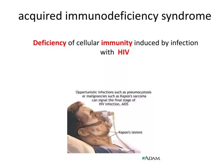 acquired immunodeficiency syndrome deficiency of cellular immunity induced by infection with hiv