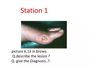 picture 6.13 in brows : Q.describe the lesion ? Q. give the Diagnosis ..?.