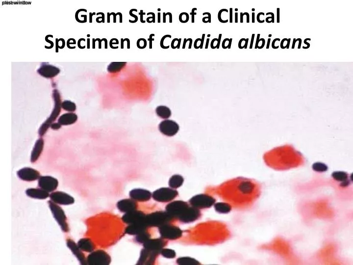 gram stain of a clinical specimen of candida albicans