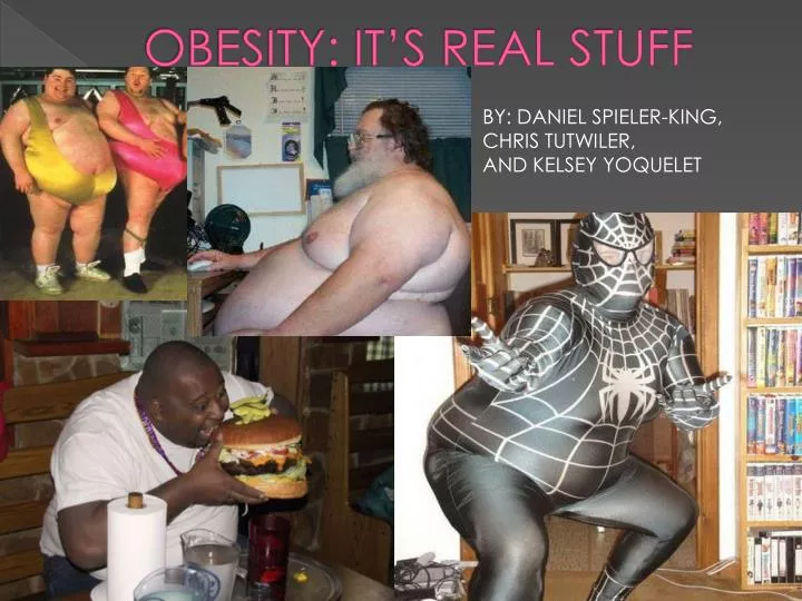 obesity it s real stuff