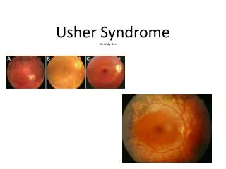 Usher Syndrome