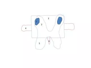 1-pedicle of L1 2- superior articular facet L1 3- body of L1 4- transverse process L1