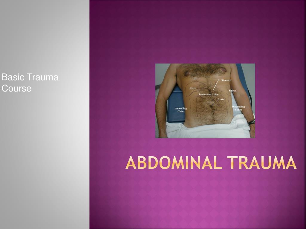 PPT - Abdominal Trauma PowerPoint Presentation, free download - ID:2016891