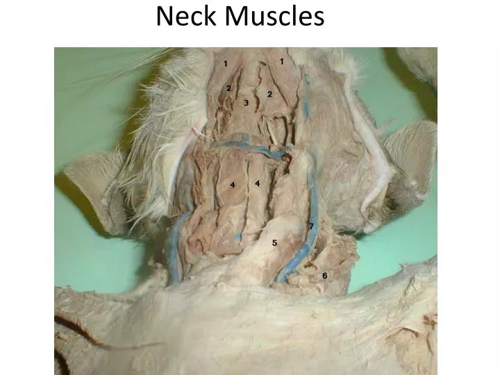 neck muscles