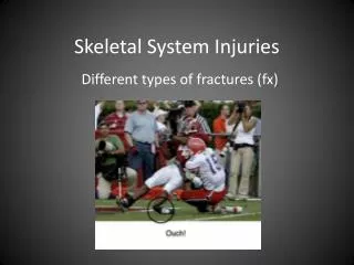 Skeletal System Injuries