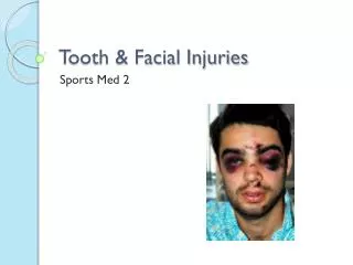 Tooth &amp; Facial Injuries