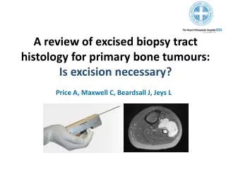 A review of excised biopsy tract histology for primary bone tumours: Is excision necessary?