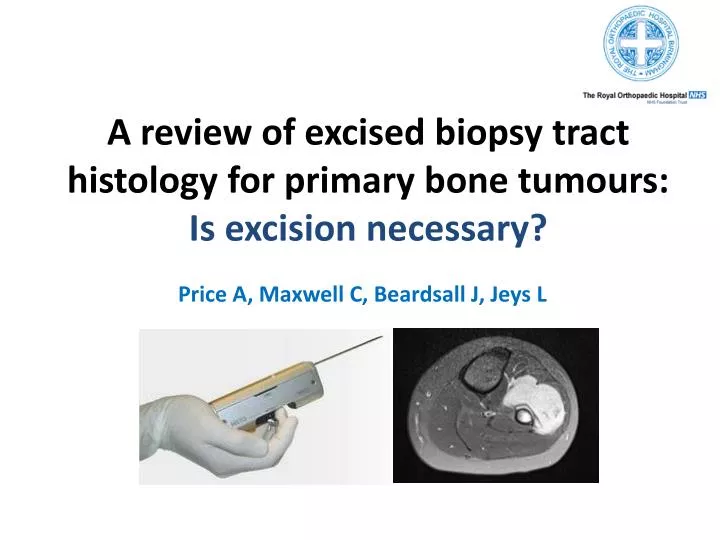 a review of excised biopsy tract histology for primary bone tumours is excision necessary