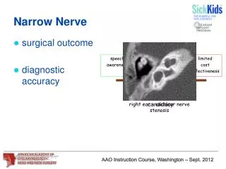 Narrow Nerve