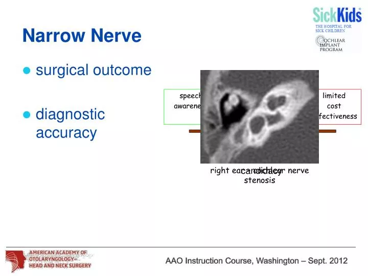 narrow nerve