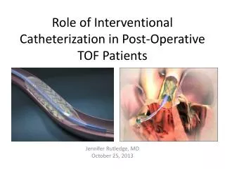Role of Interventional Catheterization in Post-Operative TOF Patients