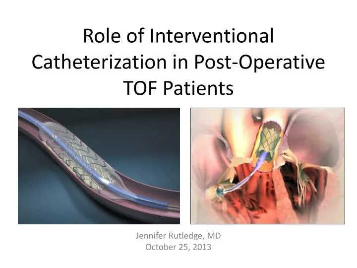 role of interventional catheterization in post operative tof patients