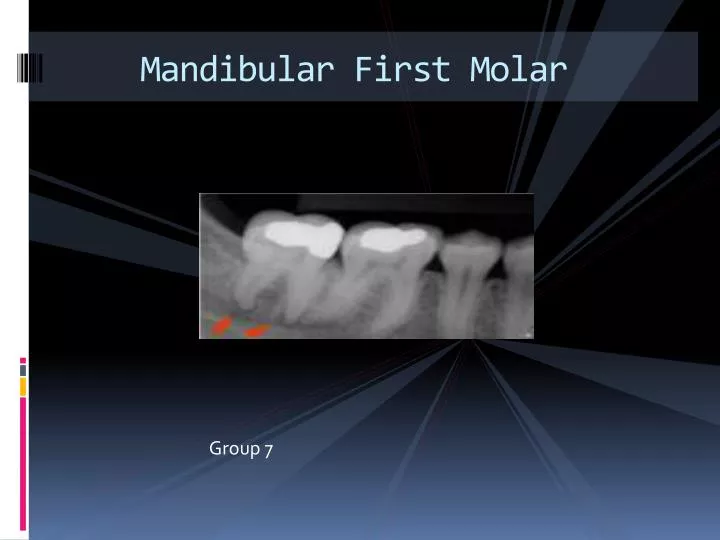 mandibular first molar