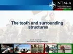 The tooth and surrounding structures - slide 1