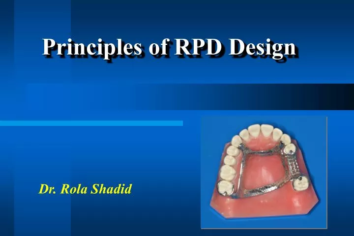 principles of rpd design