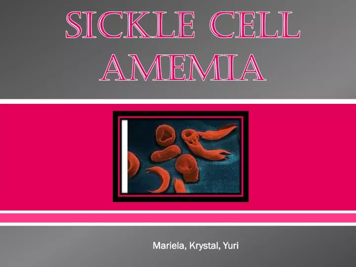sickle cell amemia