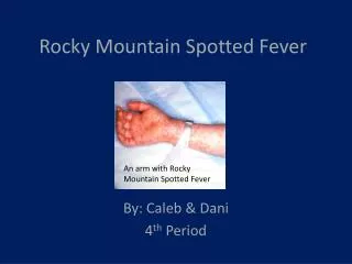 Rocky Mountain Spotted Fever