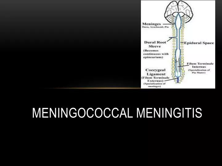 meningococcal meningitis