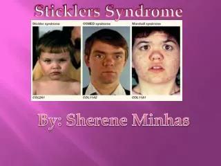 Sticklers Syndrome