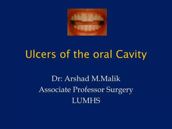 ulcers of the oral cavity