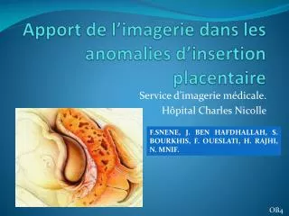 apport de l imagerie dans les anomalies d insertion placentaire