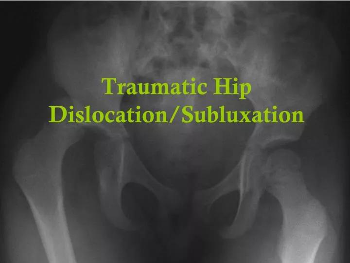 traumatic hip dislocation subluxation