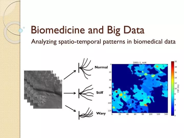 biomedicine and big data