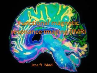 F unctional magnetic resonance imaging (fMRI
