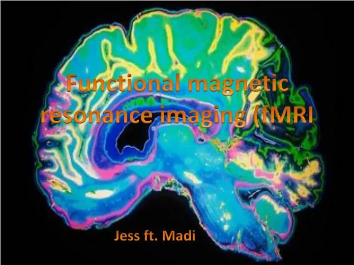 f unctional magnetic resonance imaging fmri